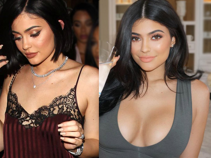 Kylie Jenner: a Breast Implant?