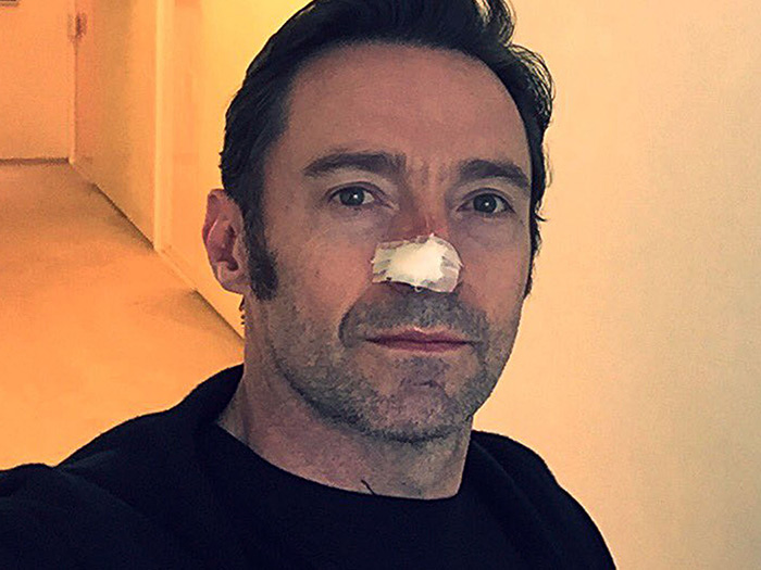 Hugh Jackman Treated for Skin Cancer for the Fifth Time